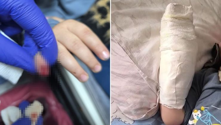 AVM’de yürüyen merdivene eli sıkışan çocuğun parmağı koptu