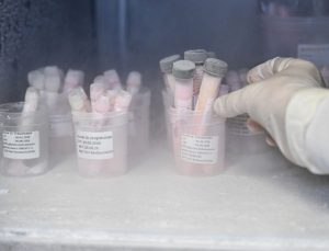 Türkiye’nin tek deri bankası ve doku laboratuvarına bağışlar artıyor