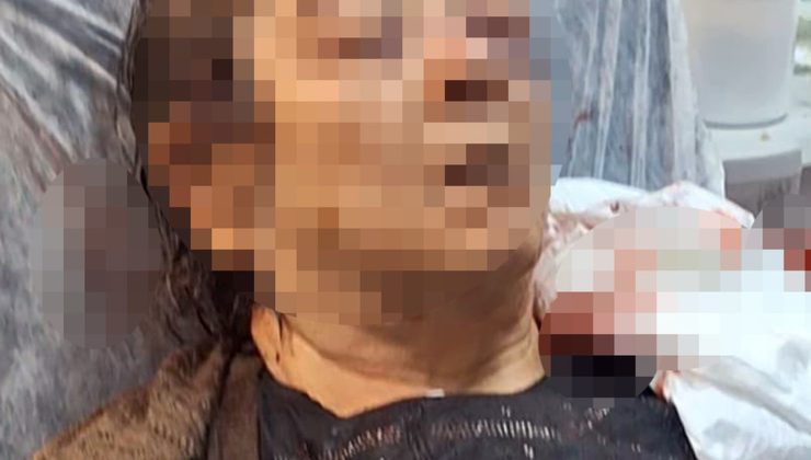 Kayseri’de evinde otururken tavan sıvası üzerine çöktü! 75 yaşındaki kadının sol gözünde ciddi görme kaybı