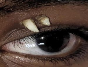 Tıp tarihinde bir ilk! Muayene eden doktorlar bile inanamadı